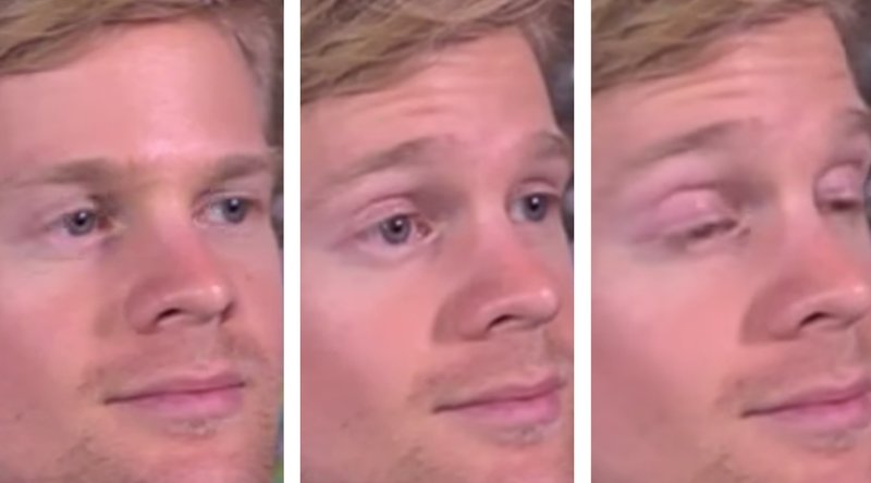 The blinking guy The blinking guy